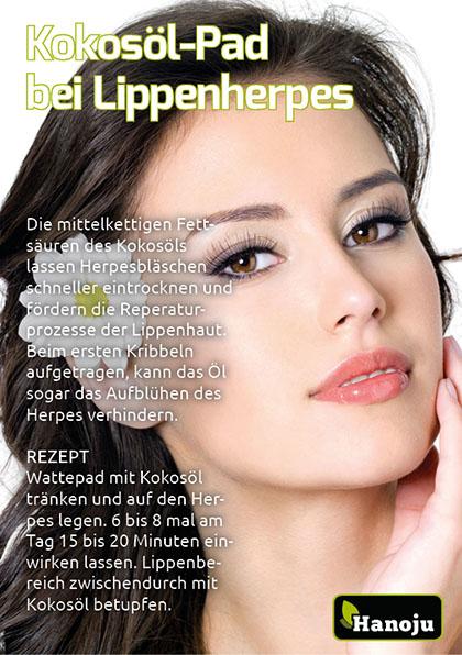 Kokosöl-Pad bei Lippenherpes
